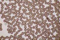 Didymium squamulosum