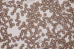 Didymium squamulosum