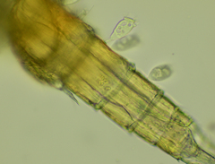 Sessilida