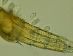 Sessilida