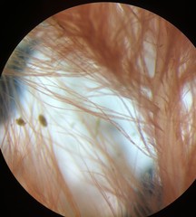 Callithamnion corymbosum