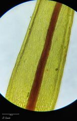 Imbribryum alpinum