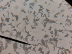Penicillium digitatum