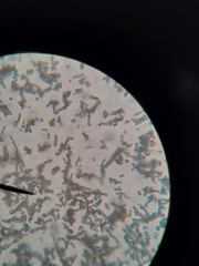 Penicillium digitatum