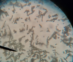 Penicillium digitatum