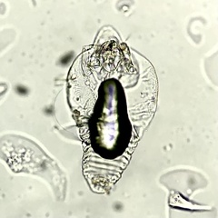 Eriophyoidea
