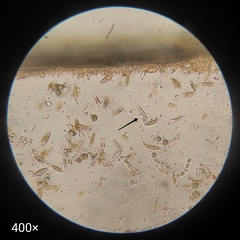 Protozoa