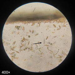 Protozoa