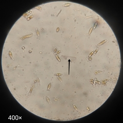 Bacteria