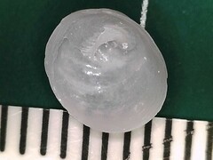 Calyptraea centralis