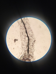 Stemonitis
