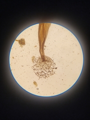 Cribraria intricata