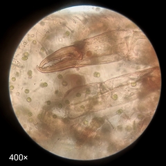 Arthropoda