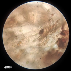 Arthropoda