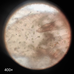 Arthropoda