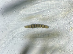 Preussia octomera