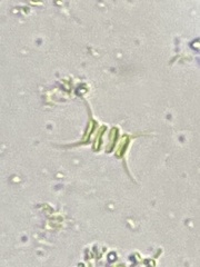 Scenedesmaceae