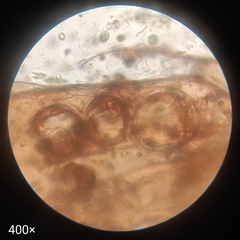 Arthropoda