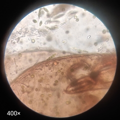 Arthropoda