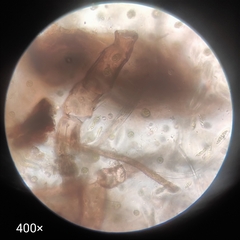 Arthropoda