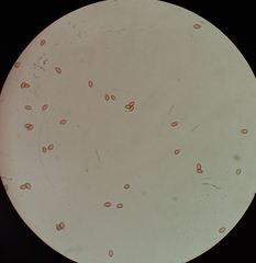 Hebeloma