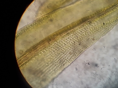 Macromitrium microstomum