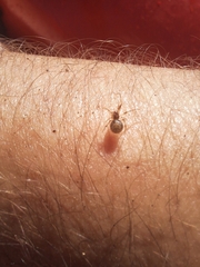 Cryptachaea veruculata