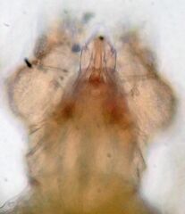 Cheyletidae