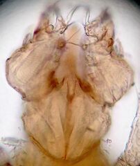 Cheyletidae