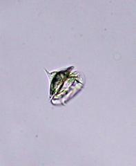 Aspidisca turrita