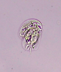 Aspidisca turrita
