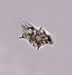 Aspidisca turrita
