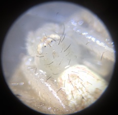 Thomisidae