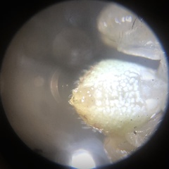 Thomisidae
