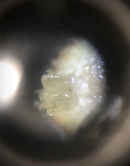 Thomisidae