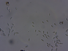 Cresponea chloroconia