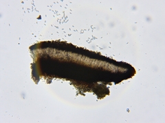 Cresponea chloroconia