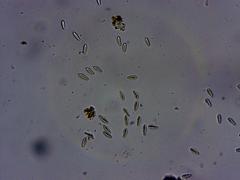 Cresponea chloroconia