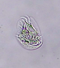 Aspidisca turrita