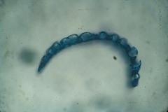 Sphagnum capillifolium