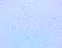 Calycina confluens
