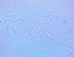 Calycina confluens