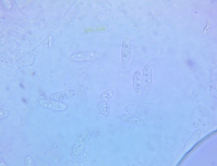 Calycina confluens