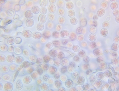 Tulasnella aurantiaca