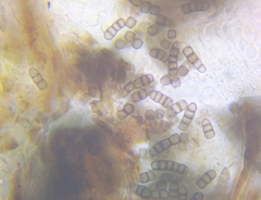 Tulasnella aurantiaca