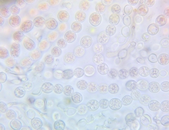 Tulasnella aurantiaca