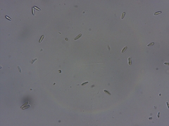 Cresponea chloroconia