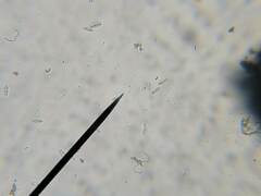 Cresponea chloroconia