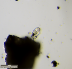 Euglypha