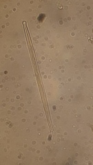Fragilaria